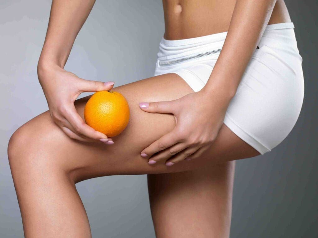 Immagine di una donna in biancheria intima bianca che tiene un'arancia contro la coscia, simboleggiando la cellulite.